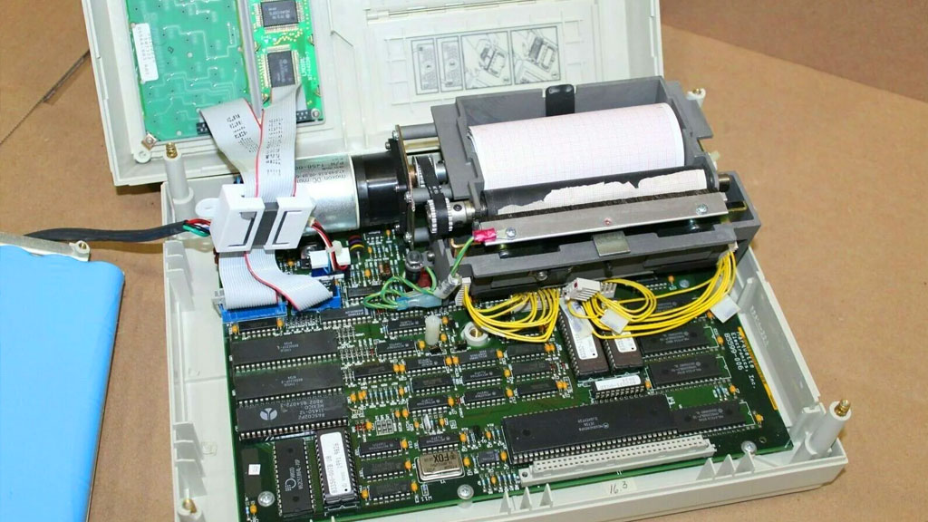 EKG Cihazı Elektrot Bağlantı Hatası Sorunu